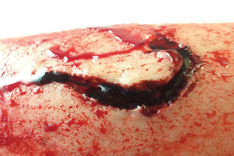 Close-up of deep flesh wound