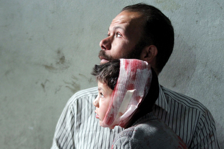 Injured boy with father, Damascus, 2015