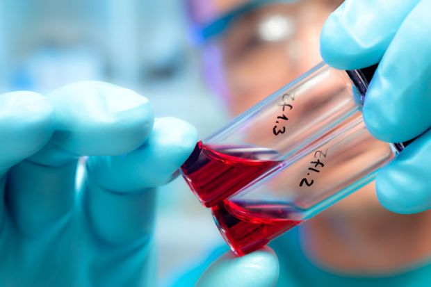 Person holding blood samples in test tubes