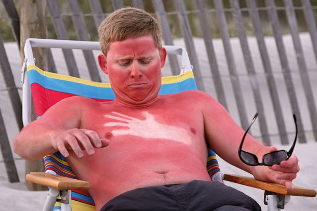 A sunburned man